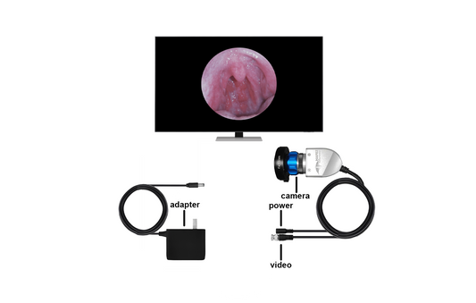 BASIC ENT camera (SKU: 700)