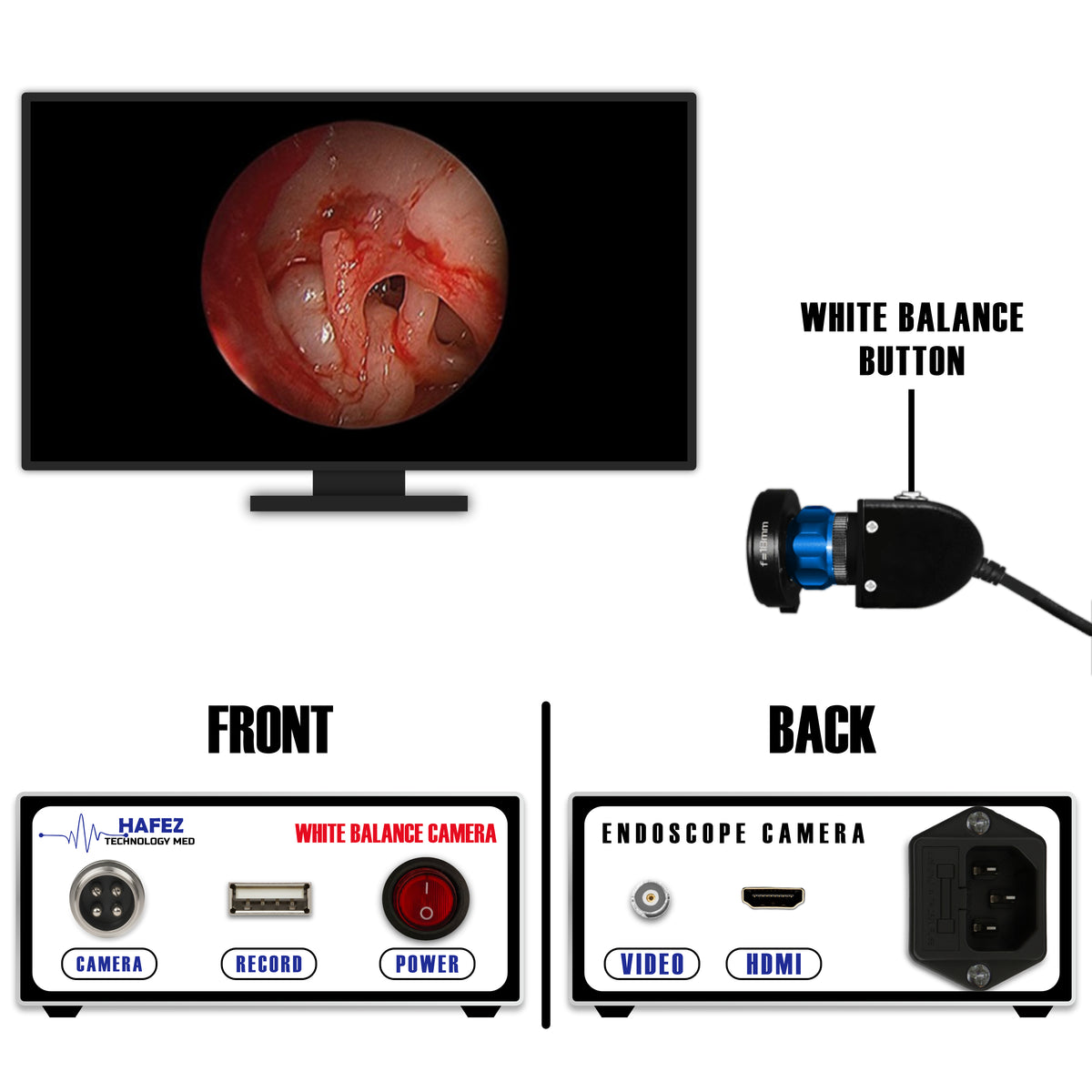 ULTRA ENT Camera (SKU: 702)