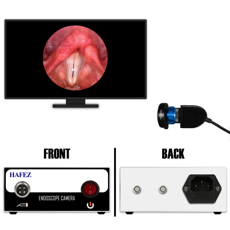 HIGH ENT Camera (SKU: 701)