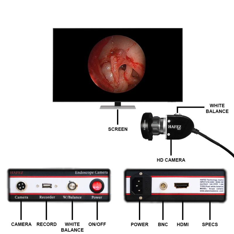 ULTRA ENT Camera (SKU: 702)