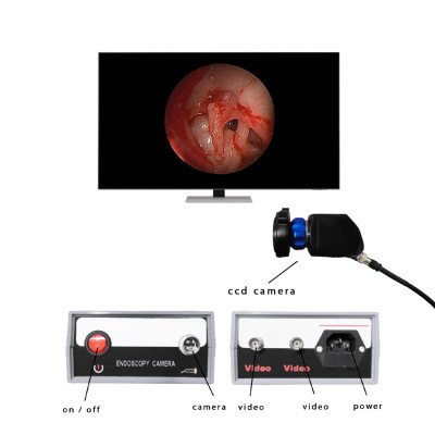 HIGH ENT Camera (SKU: 701)